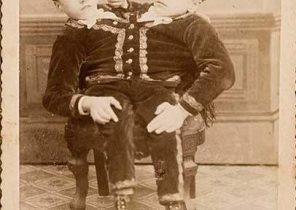 تصاویر عجیب دیده نشده از بازیگران سیرک در قرن ۱۹
