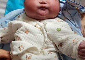 تولد نوزاد ۷ کیلویی در چین +تصاویر
