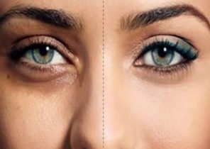 بهترین روش های درمانی برای رفع سیاهی دور چشم
