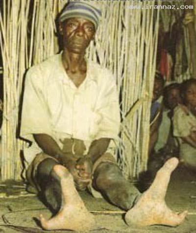 پاهای بسیار عجیب افراد قبیله ای آفریقایی/عكس