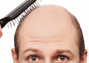 ۸ اشتباه رایجی که موهایتان رابه سرعت چرب می‌کند