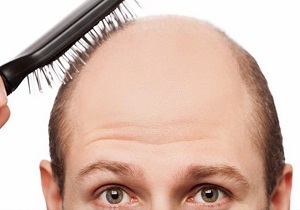 ۸ اشتباه رایجی که موهایتان رابه سرعت چرب می‌کند