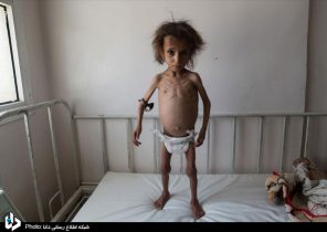 تشدید بحران انسانی در یمن‎/تصاویر