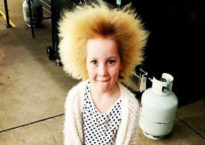 دختر ۷ ساله مبتلا به سندروم موهای شانه نشدنی