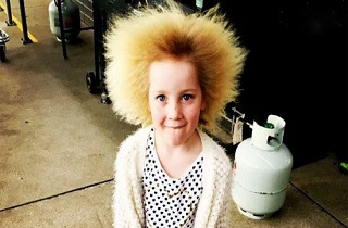 دختر ۷ ساله مبتلا به سندروم موهای شانه نشدنی