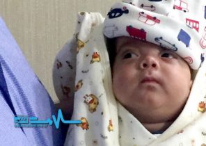 تولد زودهنگام نوزاد با وزن ۶۱۰ گرم در هند