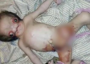 تولد نوزادی که باعث ترس و وحشت مردم روستا شد + تصاویر (۱۴+)