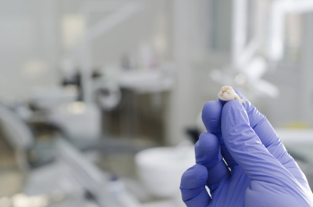 تولید دستگاهی برای استخراج سلول‌های بنیادی از دندان