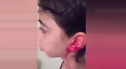 دختری که از طریق گوش‌ها و بینی اش خون گریه می‌کند + فیلم