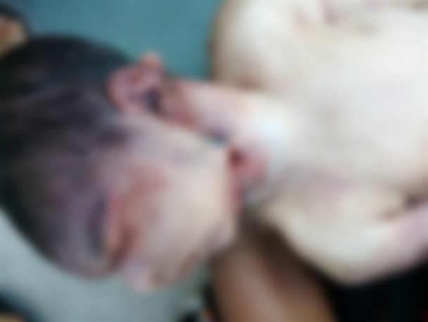 ماجرای مرگ ابهام آمیز یک نوزاد در بیمارستان ایرانشهر/ سر نوزاد جدا شد!+ تصویر