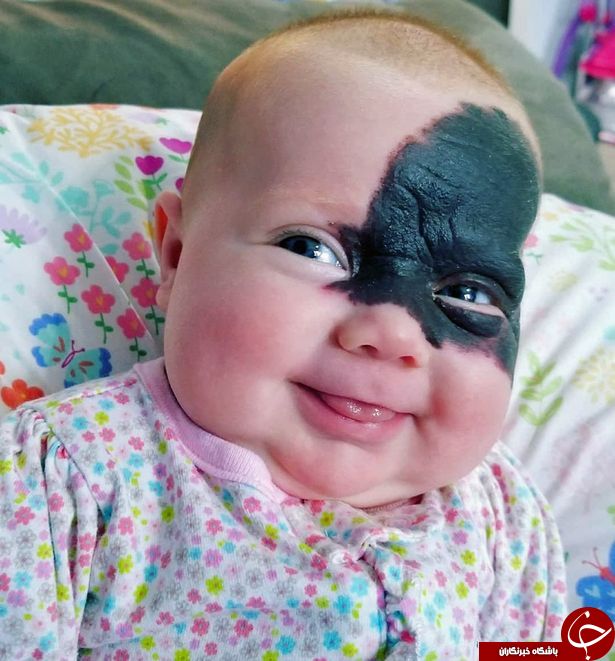 صورت عجیب نوزاد، والدینش را به وحشت انداخت! +تصاویر