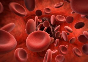 آیا پایین بودن پلاکت خون نشانه سرطان است + علل و تعداد نرمال پلاکت خون