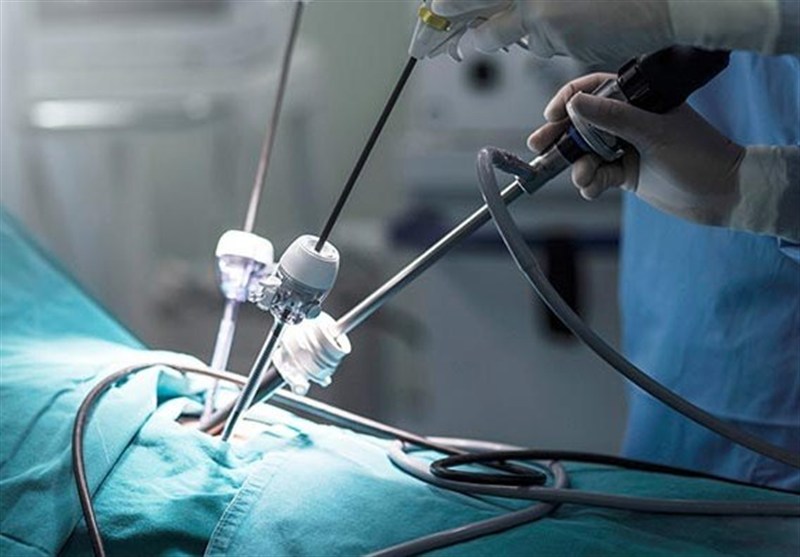 عمل جراحی لاپاراسکوپی موفق در کرج/ خروج کیست مویی ۱۰ سانتی