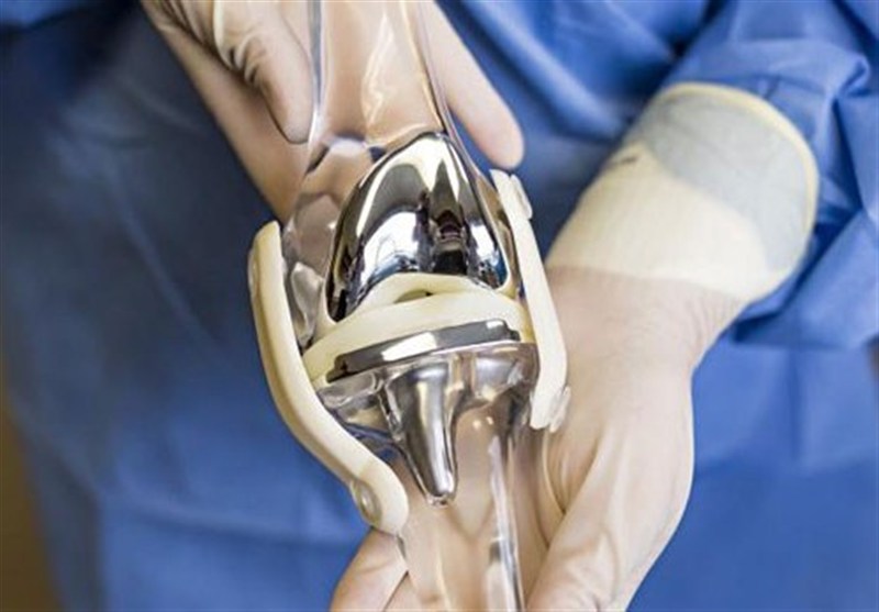 انجام ۷۰۰ عمل تعویض مفصل در البرز/ کمبود دارو نداریم